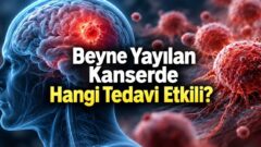 Beyin Metastazı Nedir? Belirtileri ve Tedavisi