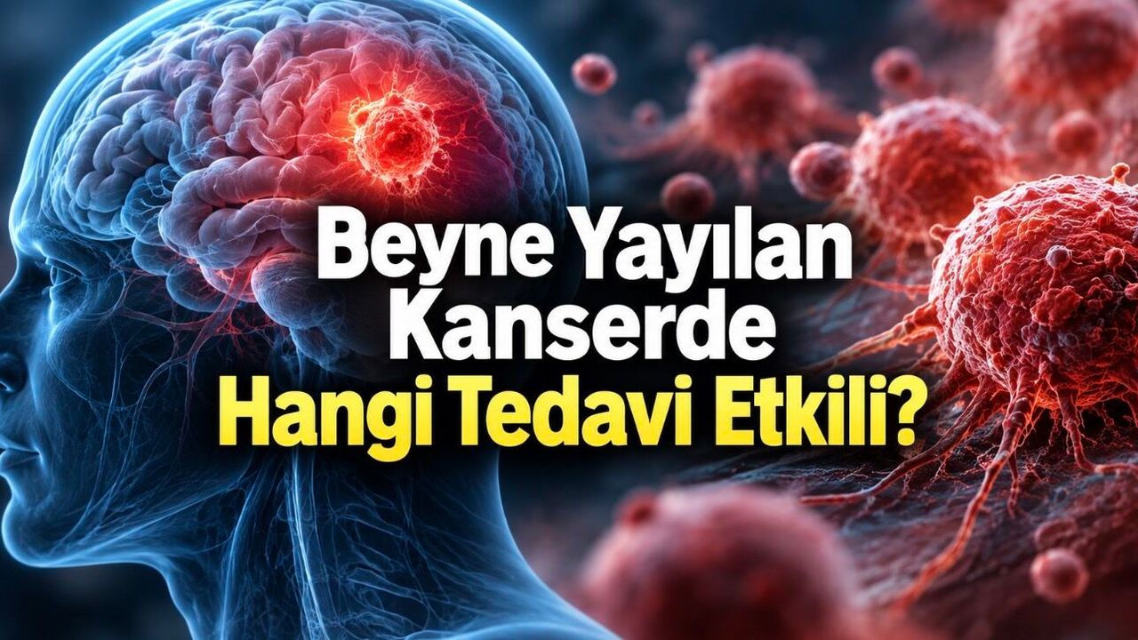 Beyin Metastazı Nedir? Belirtileri ve Tedavisi