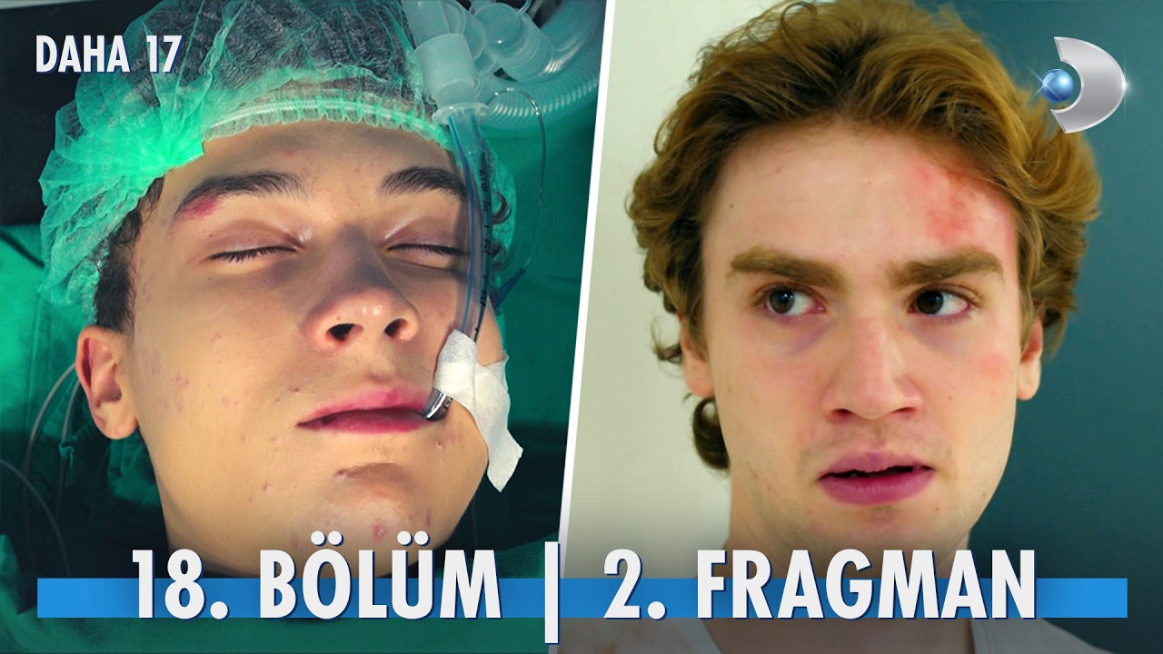 Daha 17’nin 18. Bölüm 2. Fragmanı Yayınlandı! “Abiler kardeşlerini korur…”