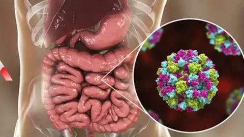 Gündemdeki konu Norovirüs: nedir?