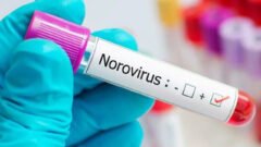 Norovirüs hakkında merak edilenler: nedir?