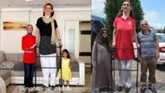 Rümeysa Gelgi kimdir, kaç yaşında, nereli, boyu kaç? Dünyanın en uzun kadınının hastalığı, mesleği ve Guinness rekorları