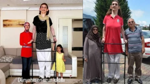 Rümeysa Gelgi kimdir, kaç yaşında, nereli, boyu kaç? Dünyanın en uzun kadınının hastalığı, mesleği ve Guinness rekorları
