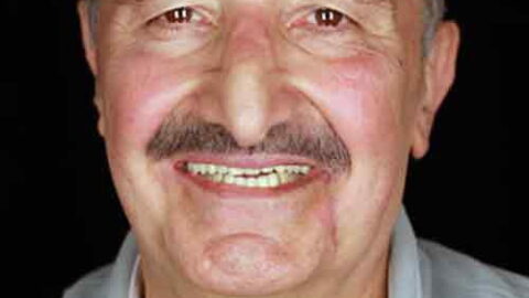 Yaşar Güner Kimdir, Ne Zaman Öldü? Yaşar Güner Hayatı, Dizileri ve Filmleri